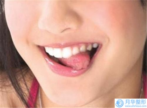 漯河做減肥吸脂手術(shù)價格受到什么影響