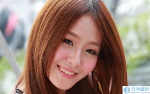 南昌市胡冬琴整形醫(yī)生激光去痘印痘坑手術(shù)價格是否很貴