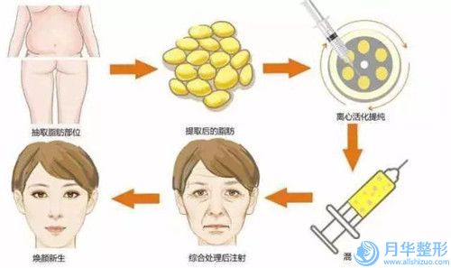 上海市唇裂二度醫(yī)院哪些靠譜（上海九院整形科是當(dāng)?shù)厝诵刨嚨尼t(yī)美機(jī)構(gòu)）