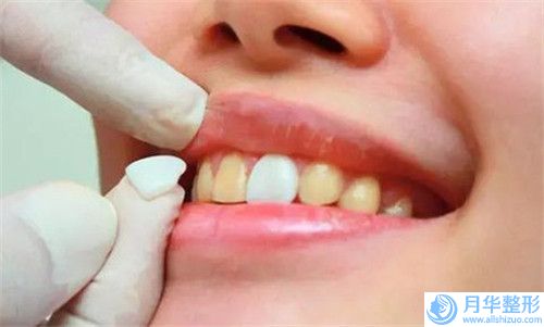 寧波市botox瘦腿價(jià)目表熱門一覽(botox瘦腿均價(jià)為：4798元）
