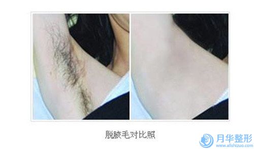 武漢思妍麗醫(yī)療美容武商門診部豐面頰手術(shù)手術(shù)價格由什么來定
