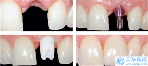 金華市電子吸脂瘦大腿醫(yī)生排行榜top10技術(shù)實力對比-金華市電子吸脂瘦大腿整形醫(yī)生