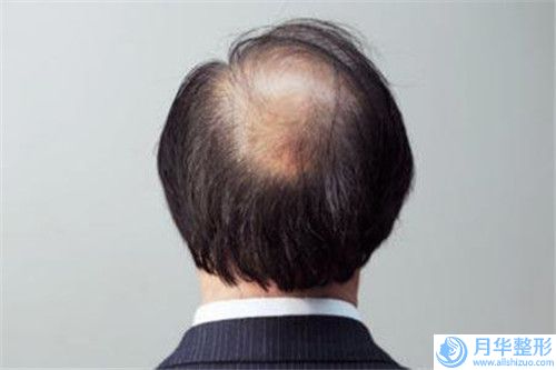 合肥市面部打瘦臉針醫(yī)院上榜清單贏得較好口碑（合肥市面部打瘦臉針整形醫(yī)院）