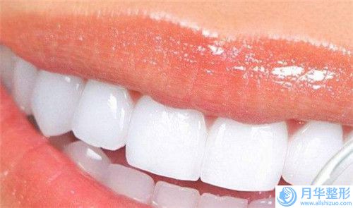 賀州水動(dòng)力吸脂瘦身費(fèi)用是多少吶
