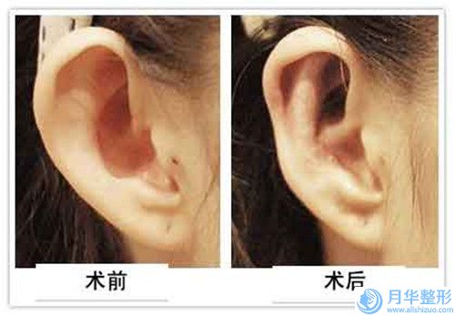 新鄉(xiāng)市乳暈乳頭縮小價(jià)格收費(fèi)表熱門一覽-新鄉(xiāng)市乳暈乳頭縮小平均費(fèi)用是多少