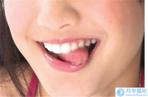 昆明上臂水動(dòng)力吸脂術(shù)的費(fèi)用怎么樣呢