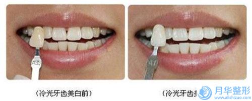 王魁然整形醫(yī)生腿部抽脂當(dāng)?shù)鼐W(wǎng)友強(qiáng)薦-梅州皇佳貝麗醫(yī)學(xué)美容門診部