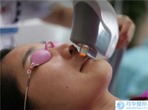 信陽(yáng)電波拉皮面部緊致提升術(shù)是不是很貴