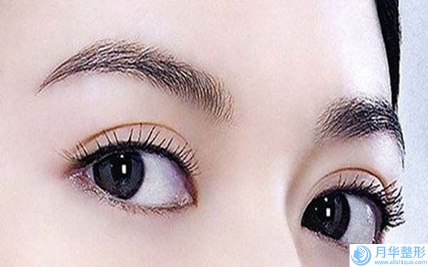 婁底激光點(diǎn)斑點(diǎn)痣手術(shù)后的效果能維持多久