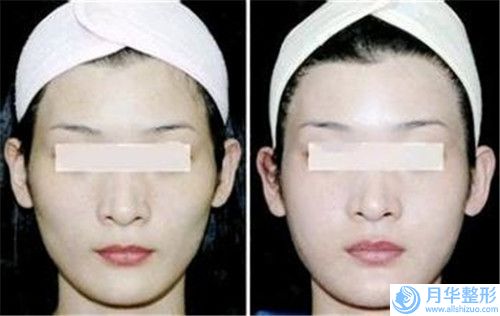 南京市兔唇修復(fù)整形價格一般都是多少呢-南京美萊醫(yī)療美容醫(yī)院價格表