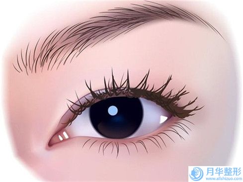 邵陽開眼角開大手術(shù)價格大概是多少區(qū)間