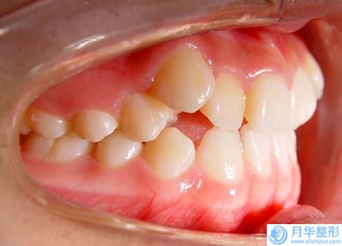 楚雄溶脂瘦身手術(shù)的性價(jià)比很高