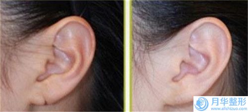 國內(nèi)外科隆胸醫(yī)院推薦：外科隆胸醫(yī)院前50佳已出圈