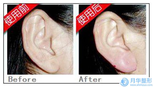 全國水滴型假體豐胸醫(yī)院推薦：水滴型假體豐胸醫(yī)院前50強(qiáng)剛剛公布口碑評價高