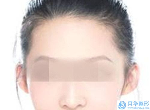 寧波市第二醫(yī)院自體豐胸失敗修復醫(yī)生找誰