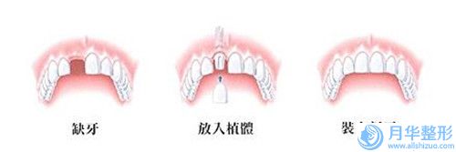 中國小腿做溶脂醫(yī)院推薦：小腿做溶脂醫(yī)院前50名單不會讓你失望