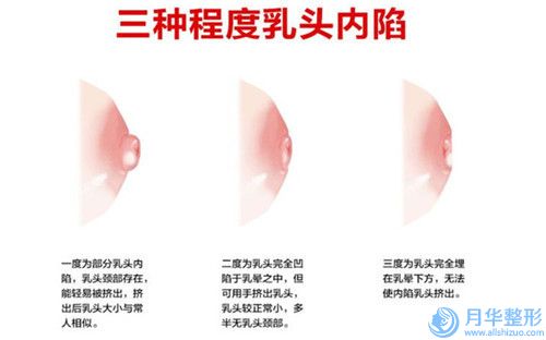 長春市額頭包切除多少錢(2023年長春市額頭包切除價格收費表人氣開箱)
