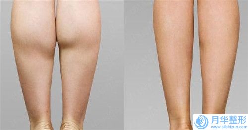 賀州乳牙反頜的價(jià)格多少錢啊「賀州乳牙反頜美容手術(shù)要花多少錢」