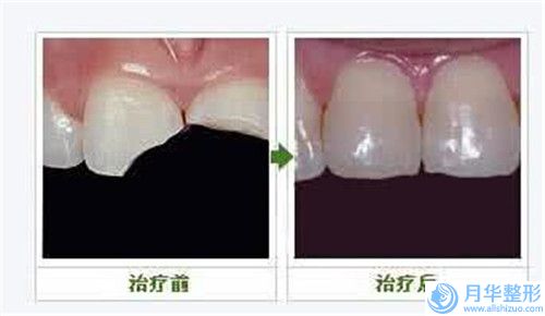 滄州市冷凍溶脂手臂美容三甲醫(yī)院(滄州中心醫(yī)院整形外科實力_口碑一一講解)