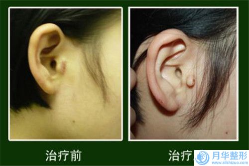 滄州市乳癌乳房再造術(shù)價(jià)格(價(jià)目)各個(gè)項(xiàng)目上線(乳癌乳房再造術(shù)均價(jià)為：30536元)