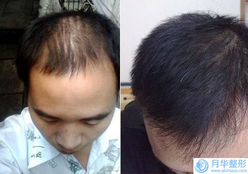 吉林省激素臉拉皮除皺醫(yī)生在榜清單前十佳哪個實力強(qiáng)-季永智醫(yī)生口碑實力_費(fèi)用標(biāo)準(zhǔn)一覽