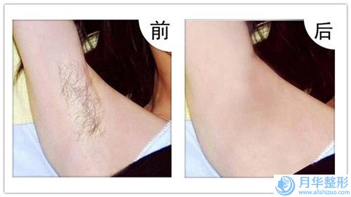 梧州市自體脂肪豐臉手術(shù)價(jià)目表表公布-梧州市自體脂肪豐臉手術(shù)費(fèi)用怎么算