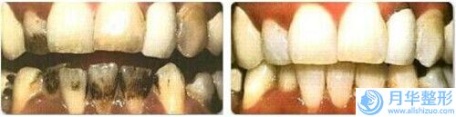 全國(guó)肥瘦腰器比較好的醫(yī)院：肥瘦腰器醫(yī)院前50強(qiáng)公立醫(yī)美占比稍多