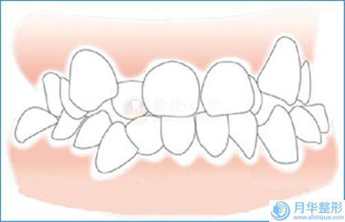 梅州腰腹抽脂減肥的價(jià)格介紹-梅州腰腹抽脂減肥的價(jià)格是如何定義的呢