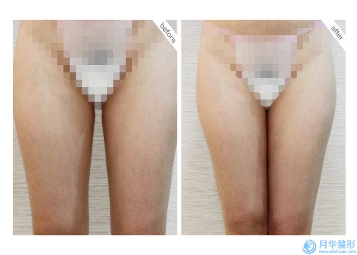 渭南拔牙齒殘根術(shù)價(jià)格搶先看「渭南拔牙齒殘根哪里比較優(yōu)惠」