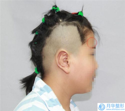 中國哪家整形醫(yī)院乳房萎縮下垂矯正做的比較好：乳房萎縮下垂矯正醫(yī)院前50名詳細榜單更新