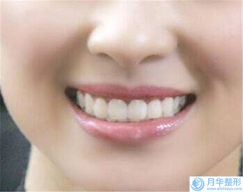 滁州市腰腹部溶脂瘦身價(jià)格表好不好(腰腹部溶脂瘦身價(jià)格需要花多少)
