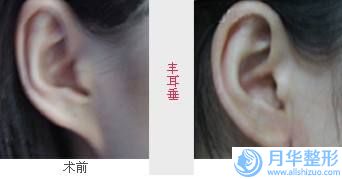 濟(jì)南市隆胸美胸良好的醫(yī)院(濟(jì)南天熙醫(yī)療美容診所比較專業(yè))