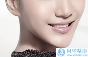 漯河市墊下巴假體價(jià)格(價(jià)目)（信息）查詢(墊下巴假體整形手術(shù)費(fèi)用是多少)