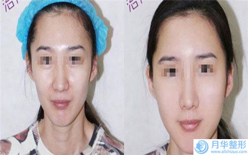 中國Z成形法眉位不正整形醫(yī)院整形：Z成形法眉位不正整形醫(yī)院50強優(yōu)選分享