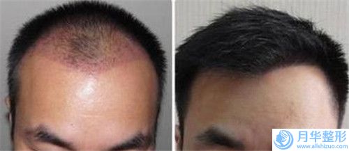 齊齊哈爾市瓷貼面美容牙顆醫(yī)生在榜名單案例遍布省內(nèi)各地-齊齊哈爾市瓷貼面美容牙顆口腔醫(yī)生