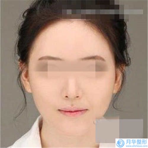 國內(nèi)下巴溶脂手術(shù)醫(yī)院較好：下巴溶脂手術(shù)醫(yī)院50強剛剛更新