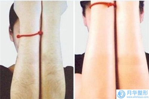 黔南瘦臉注射后有哪些不良反應(yīng)