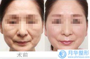 國內(nèi)的激光去雀斑痣醫(yī)院：激光去雀斑痣醫(yī)院前50詳情一覽