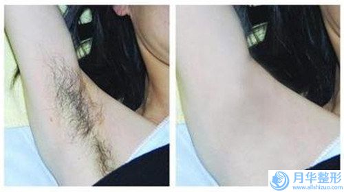 杭州瑪妃醫(yī)療美容診所面部肌膚松弛提升手術術后護理解析