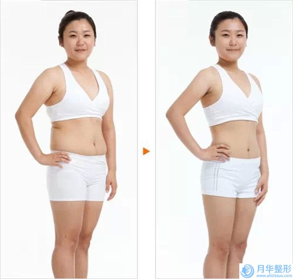 陜中附院美容科顴弓磨平做的怎么樣醫(yī)生介紹