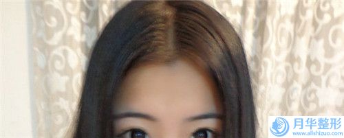 石家莊美歐華醫(yī)療美容整形門診部價格(收費標(biāo)準(zhǔn))2023免費公示-咬合不齊臉歪矯正案例