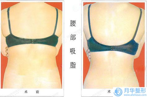 通遼市削骨瘦下巴價(jià)目表超新新鮮大揭秘(近6個(gè)月均價(jià)為：18838元)