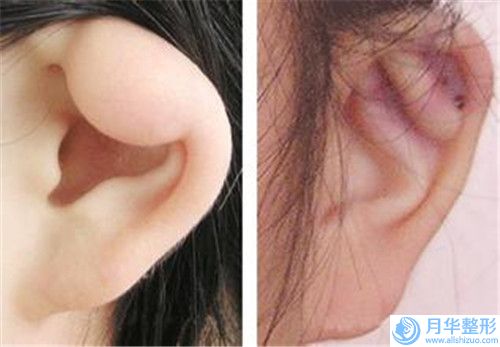 中國(guó)做乳房修復(fù)手術(shù)醫(yī)院哪兒好：做乳房修復(fù)手術(shù)醫(yī)院前50名意想不到