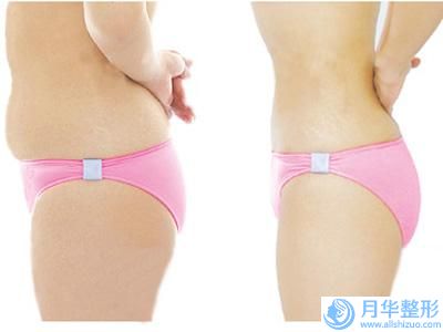 溫州樂清虹橋海琳口腔診所費(fèi)用表明細(xì)展示-牙床填骨粉美容需要花費(fèi)多少