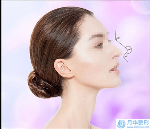 佛山唇腭裂鼻子修復(fù)會(huì)影響面部表情嗎
