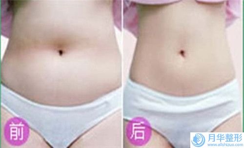 清遠(yuǎn)顴骨內(nèi)推加磨骨大的副作用的癥狀可能有哪些