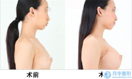 姜立山醫(yī)生額頭長痘痘治療案例-價格表全新版全新上線