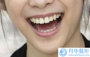 六安市知名胖子瘦雙下巴機(jī)構(gòu)哪幾家效果強(qiáng)-胖子瘦雙下巴價格大約多少