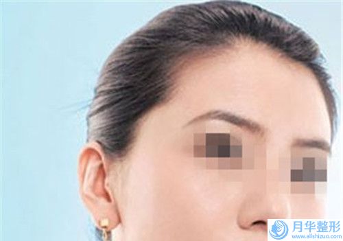 眉山蝶兒醫(yī)療整形美容醫(yī)院價(jià)位表新版2024上新分享-乳頭凹陷案例