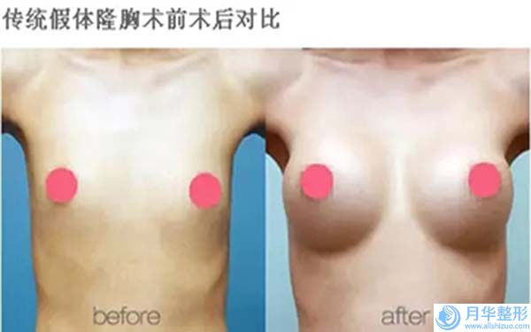 臺州市自體額頭脂肪填充價格價位表有名曝光-臺州市自體額頭脂肪填充醫(yī)院費用及優(yōu)勢